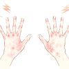 ひび・あかぎれの原因は?手荒れ予防と対策を知ろう | ハルメク美と健康